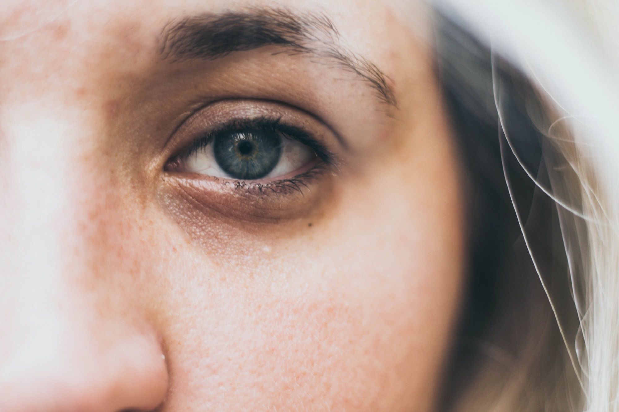 Puffy Eyes and Eye Bags: Causes and Treatments | ReviewThis