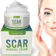 Best Scar Cream Buyers Guide 2020 ReviewThis